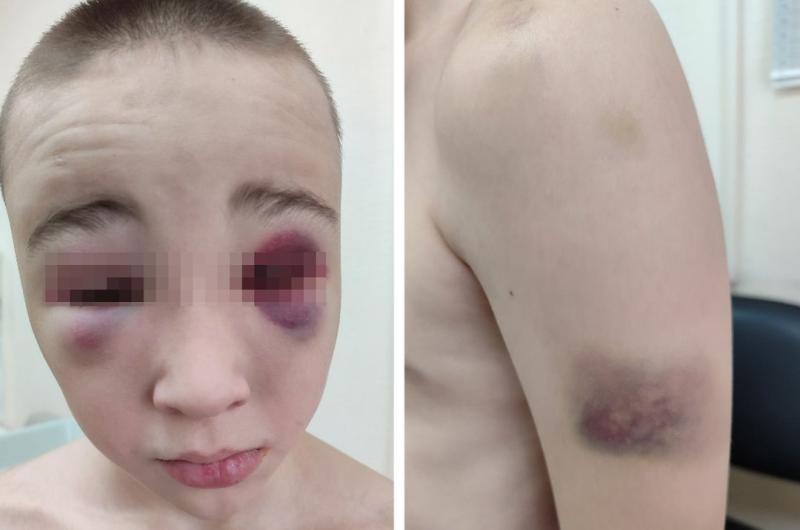 Избиение 10-летнего ребенка в военно-спортивном центре проверят в Новосибирске